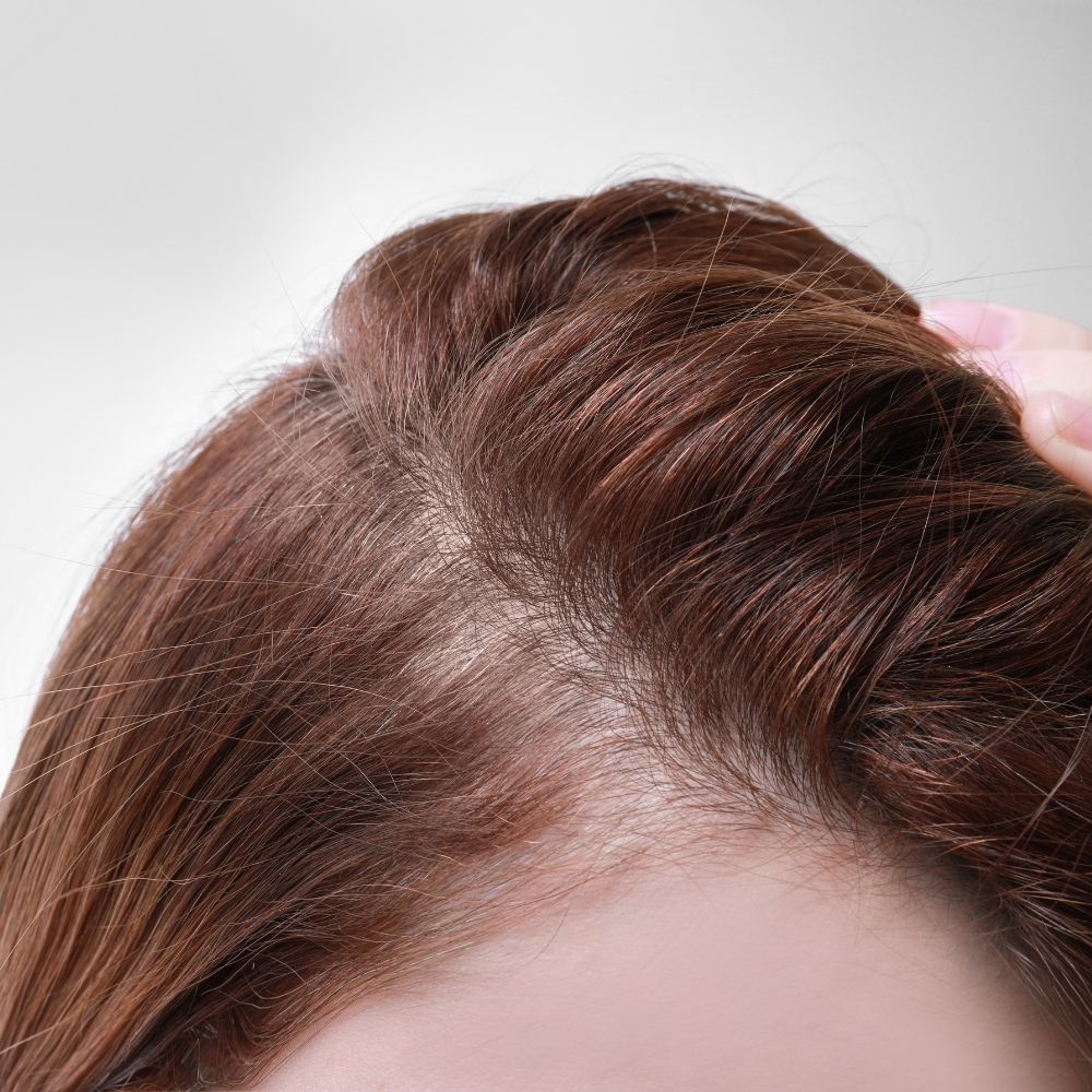 Signs of Hair Loss