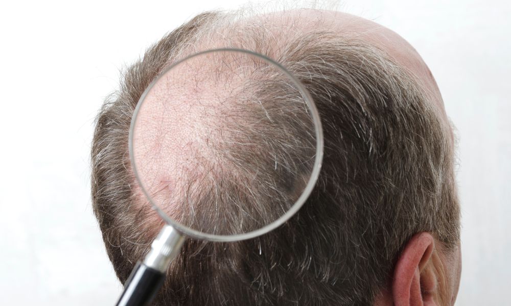 Signs Your Hair Is Growing