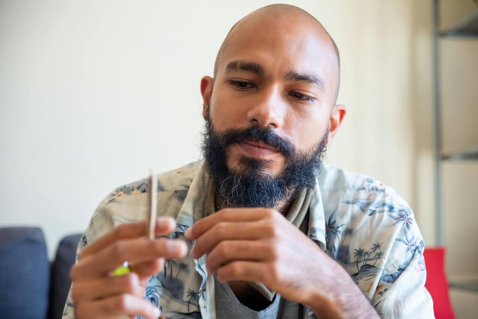 Male Hair Loss: Causes & Treatments in Singapore