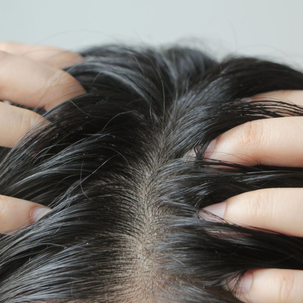 Itchy Scalp
