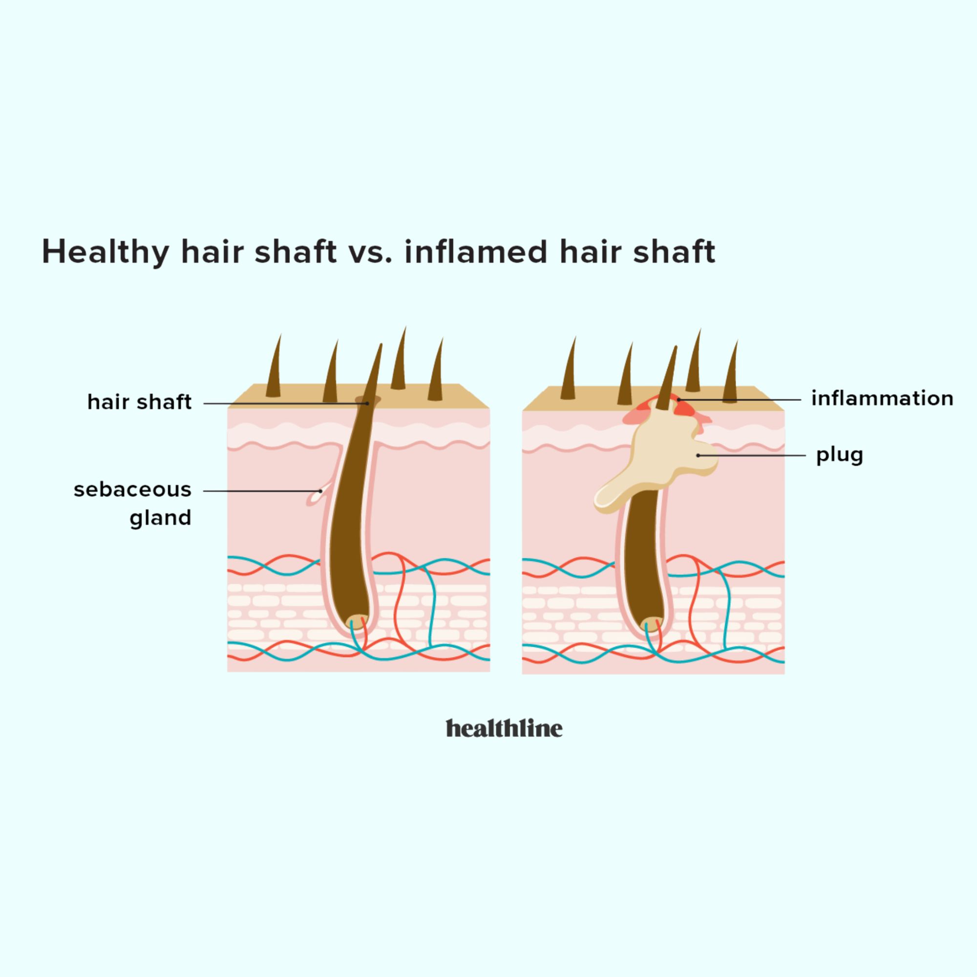 why is healthy hair important