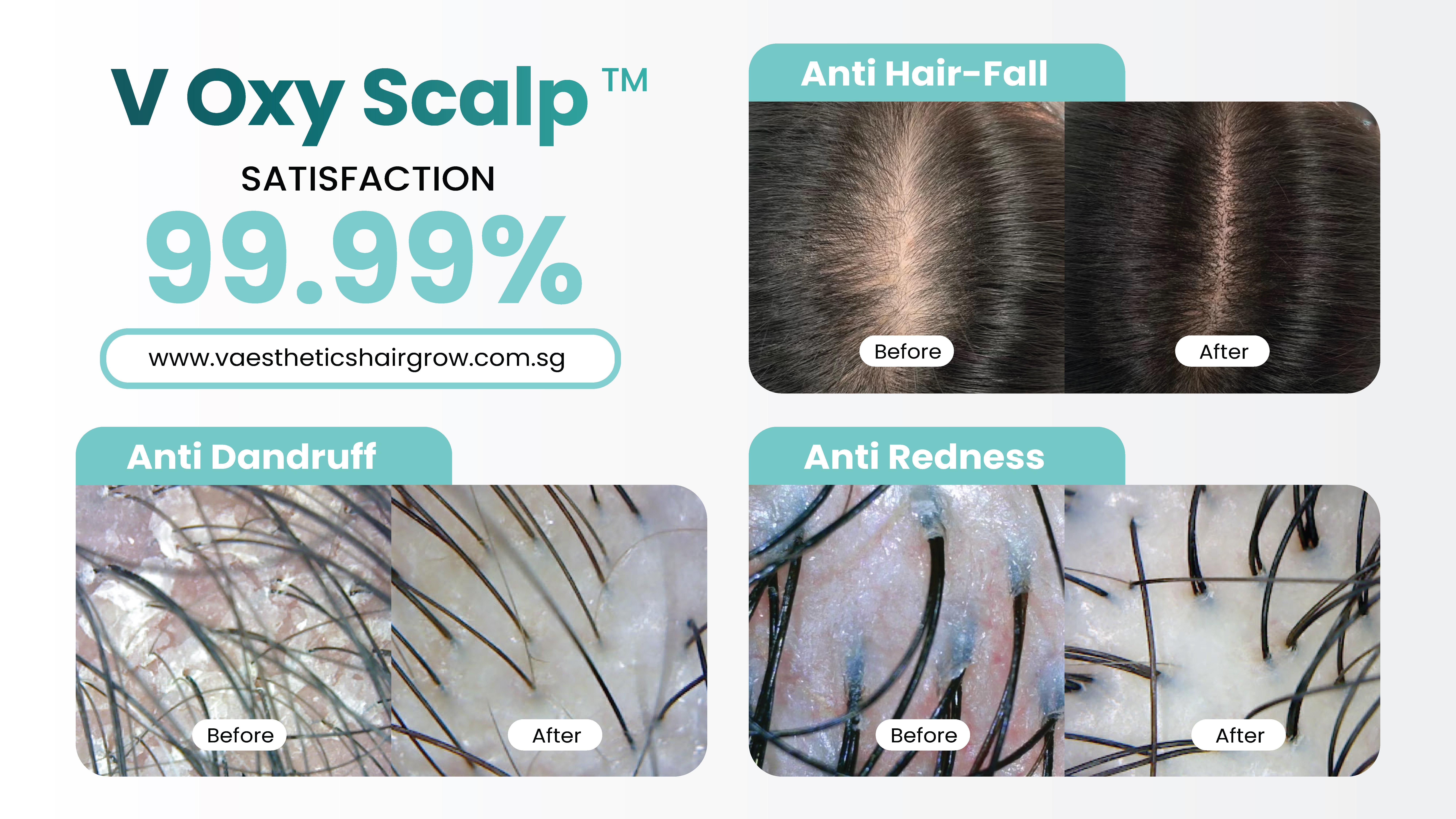 V Oxy Scalp Before & After