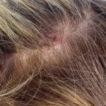 scalp sensitive