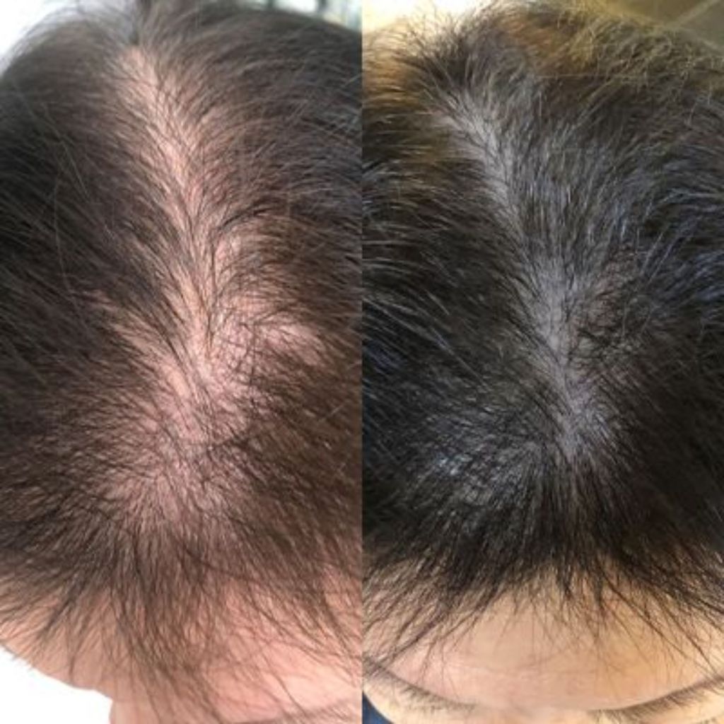 before after testimonial