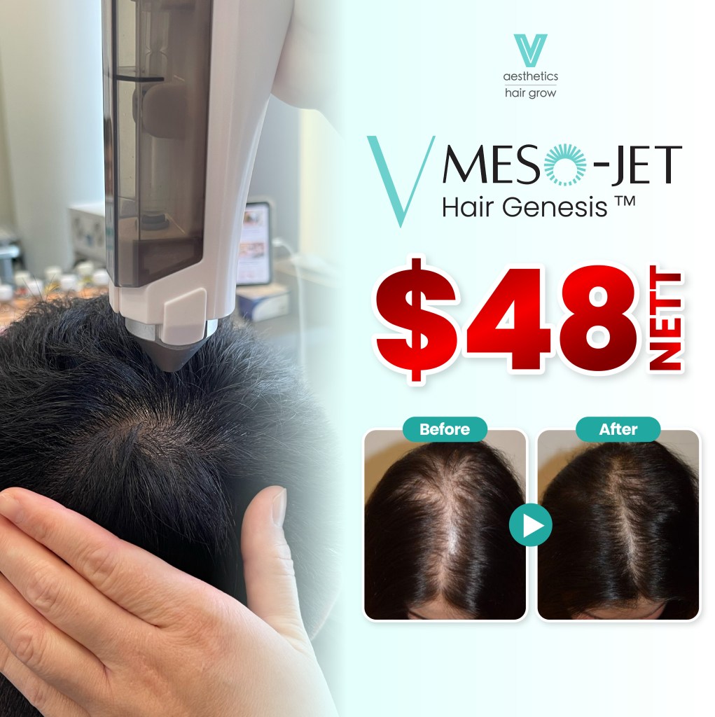 v meso jet